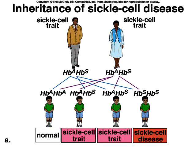 Sickle Cell Anemia Inheritance 