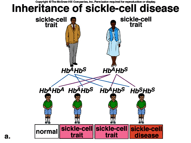 Health Living With Sickle Cell Anemia Genesis International 3939